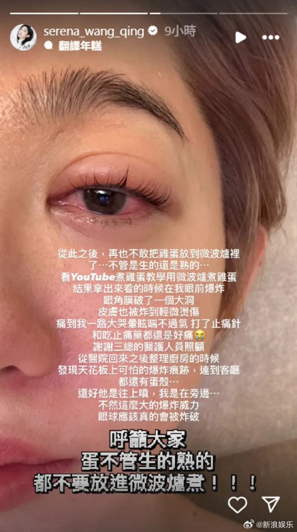 深圳配资网站 突然爆炸！女星自曝：眼球险些炸破，痛到眩晕！很多人还在尝试